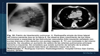 10cm 14
Ref X-Ray Exp /
 