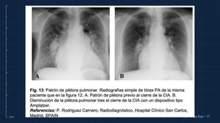 10cm 17
Ref X-Ray Exp /
 
