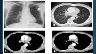 10cm 19
Ref X-Ray Exp /
 