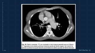 10cm 22
Ref X-Ray Exp /
 