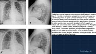 10cm 24
Ref X-Ray Exp /
 