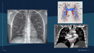 10cm 3
Ref X-Ray Exp /
 