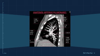 10cm 4
Ref X-Ray Exp /
 