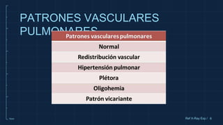 10cm
PATRONES VASCULARES
PULMONARES
6
Ref X-Ray Exp /
 