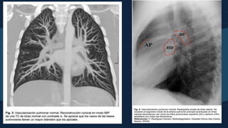 10cm 8
Ref X-Ray Exp /
 