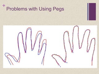 +
Problems with Using Pegs
 