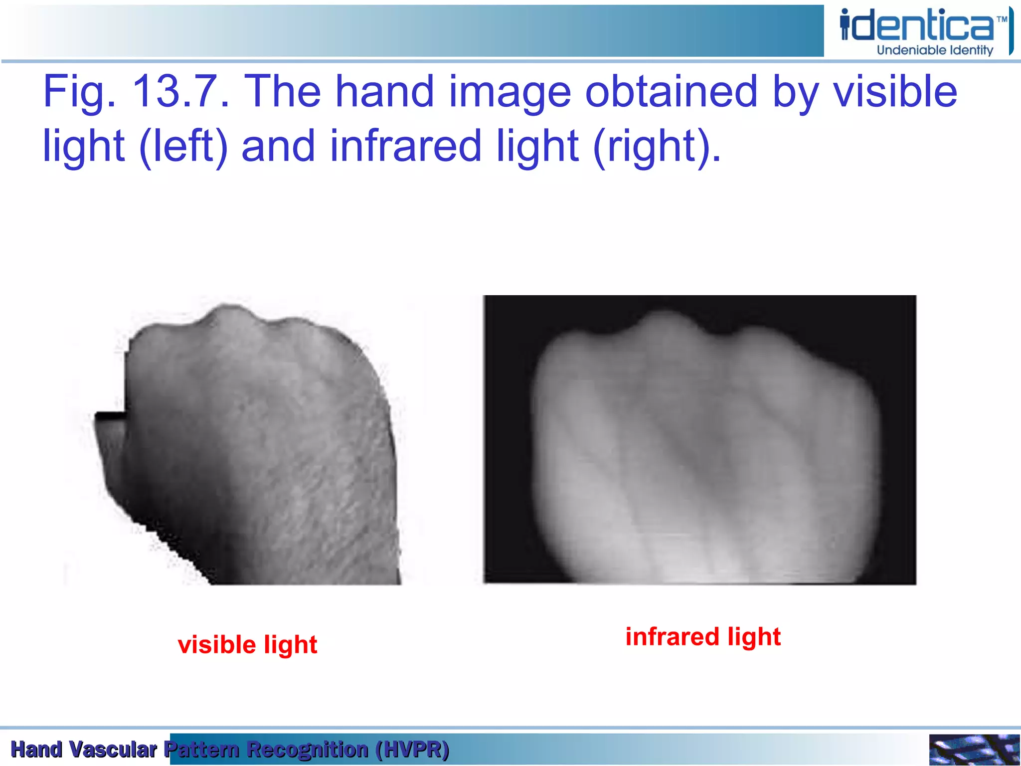 Hand Vascular Pattern Recognition (HVPR)Hand Vascular Pattern Recognition (HVPR)Hand Vascular Pattern Recognition (HVPR)Hand Vascular Pattern Recognition (HVPR)
Fig. 13.7. The hand image obtained by visible
light (left) and infrared light (right).
visible light infrared light
 