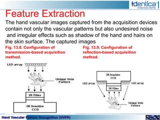 Vascular Pattern Recognition – Vascular Pattern Recognition for ...