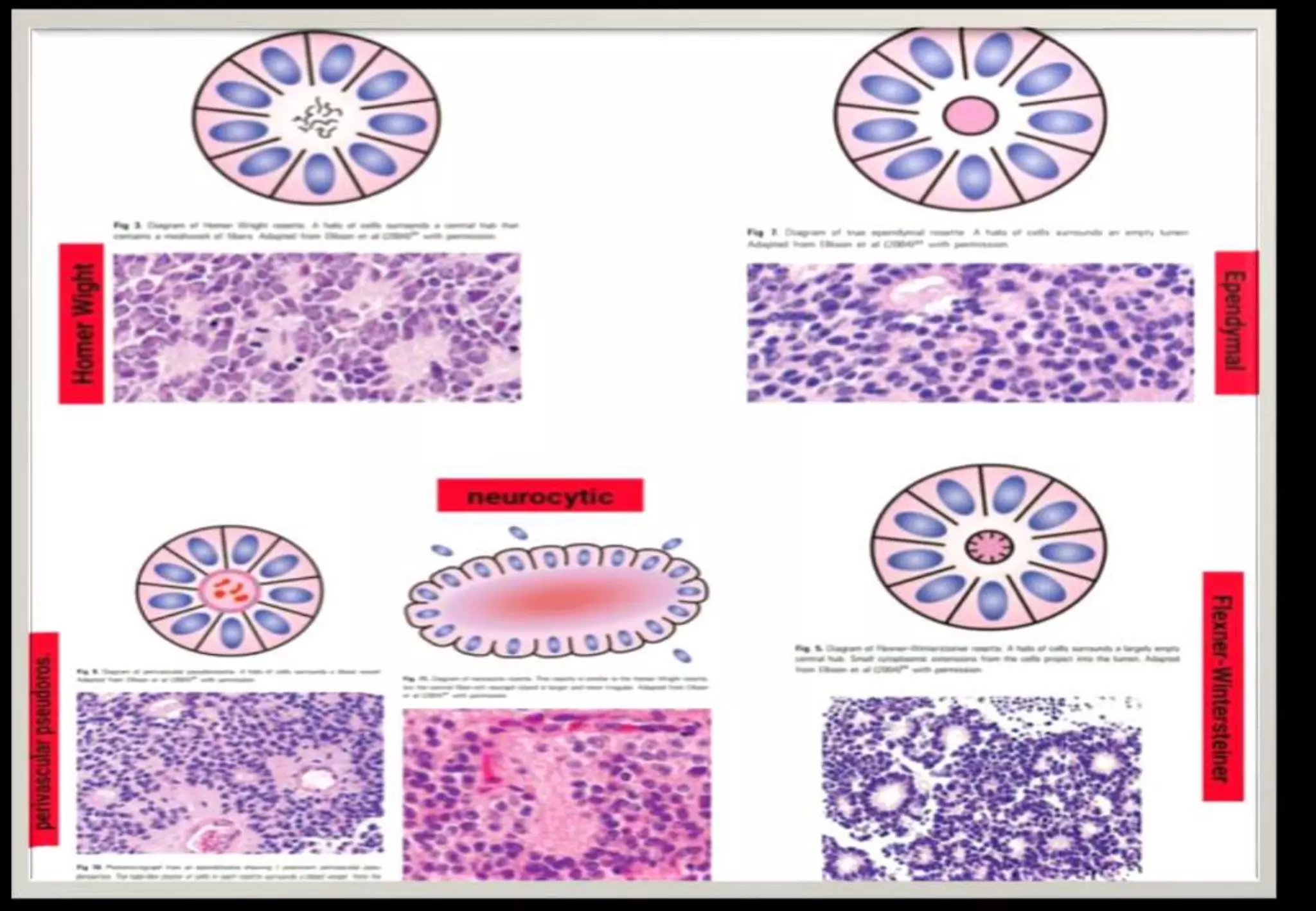 Pathophysiology Pattern Patterns in histopathology | PPTX