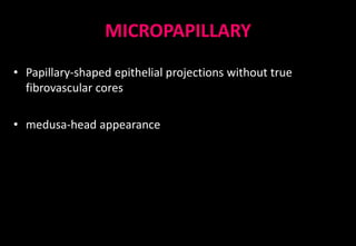 MICROPAPILLARY
• Papillary-shaped epithelial projections without true
fibrovascular cores
• medusa-head appearance
 
