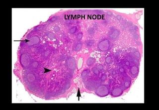 LYMPH NODE
 