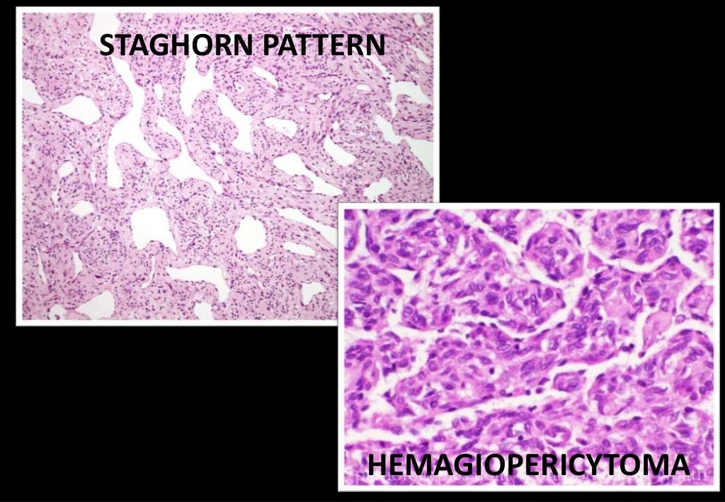 Patterns in histopathology
