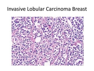 Histopathological Patterns | PPTX