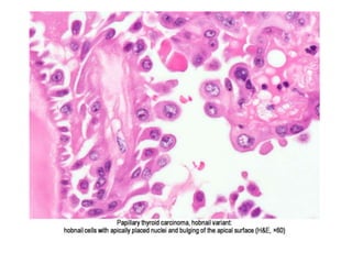 Pathophysiology Pattern Histopathological Patterns | PPTX