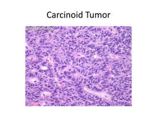 Histopathological Patterns | PPTX