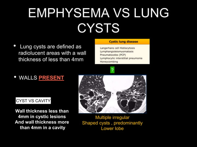 Patterns in HRCT chest | PPTX | Lung and Respiratory Health | Diseases ...