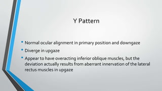 Pattern strabismus | PPTX
