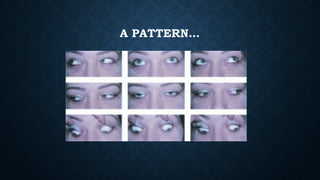 Assessment and management of Pattern Strabismus | PPTX