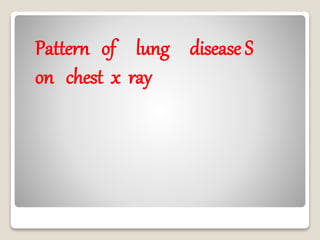 Pattern of lung disease S
on chest x ray
 