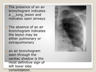 Patttern of lung disease on chest x ray | PPTX