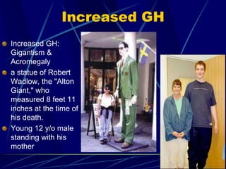 Increased GH
Increased GH:
Gigantism &
Acromegaly
a statue of Robert
Wadlow, the "Alton
Giant," who
measured 8 feet 11
inches at the time of
his death.
Young 12 y/o male
standing with his
mother
 