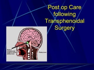 Post op Care
following
Transphenoidal
Surgery
 