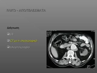 ΔιάγνωσηΔιάγνωση
 USUS
 CTCT μεμε iviv σκιαγραφικόσκιαγραφικό
 ±±ΑορτογραφίαΑορτογραφία
ΥΛΙΚΟ - ΑΠΟΤΕΛΕΣΜΑΤΑΥΛΙΚΟ - ΑΠΟΤΕΛΕΣΜΑΤΑ
 