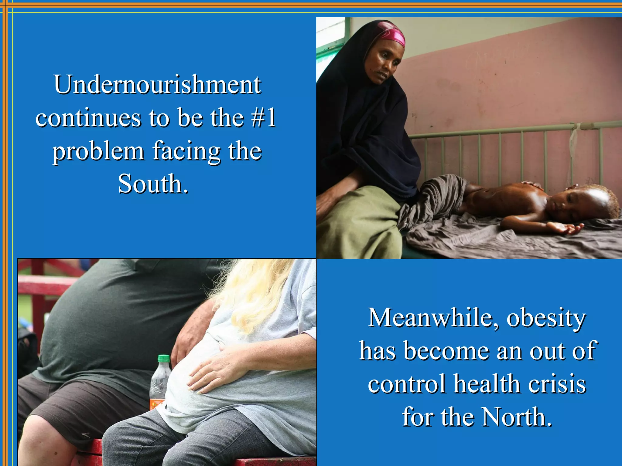 Undernourishment
continues to be the #1
 problem facing the
       South.



                          Meanwhile, obesity
                         has become an out of
                          control health crisis
                             for the North.
 