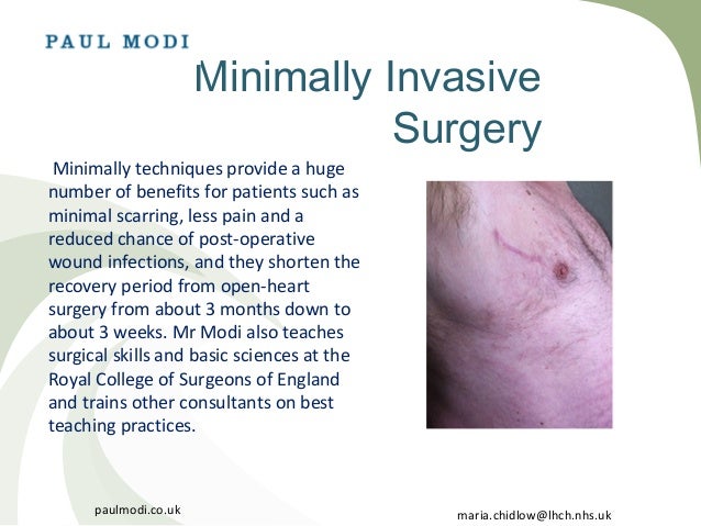 Minimally Invasive Cardiac And Heart Surgery Minimally Invasive Cardiac And Heart Surgery