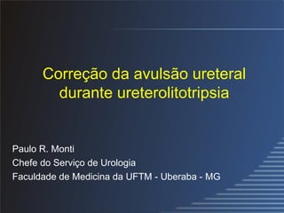 Correção da avulsão ureteral durante ureterolitotripsia Paulo R. Monti Chefe do Serviço de Urologia Faculdade de Medicina da UFTM - Uberaba - MG 