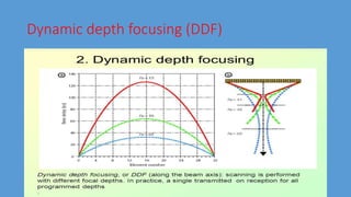 Dynamic depth focusing (DDF)
 