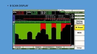 • B SCAN DISPLAY
 