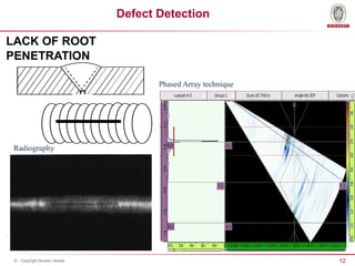 12
© - Copyright Bureau Veritas
Defect Detection
LACK OF ROOT
PENETRATION
Radiography
Phased Array technique
 