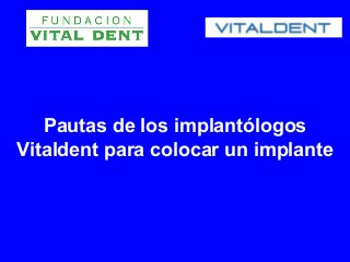 Pautas de los implantólogos
Vitaldent para colocar un implante
 