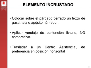 117
ELEMENTO INCRUSTADO
•Colocar sobre el párpado cerrado un trozo de
gasa, tela o apósito húmedo.
•Aplicar vendaje de contención liviano, NO
compresivo.
•Trasladar a un Centro Asistencial, de
preferencia en posición horizontal
 