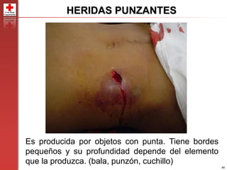 48
Es producida por objetos con punta. Tiene bordes
pequeños y su profundidad depende del elemento
que la produzca. (bala, punzón, cuchillo)
HERIDAS PUNZANTES
 
