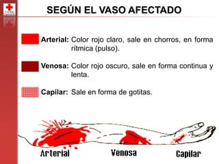 53
53
SEGÚN EL VASO AFECTADO
Arterial: Color rojo claro, sale en chorros, en forma
rítmica (pulso).
Venosa: Color rojo oscuro, sale en forma continua y
lenta.
Capilar: Sale en forma de gotitas.
 