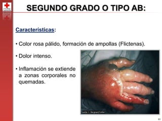 63
SEGUNDO GRADO O TIPO AB:
• Dolor intenso.
• Inflamación se extiende
a zonas corporales no
quemadas.
Características:
• Color rosa pálido, formación de ampollas (Flictenas).
 