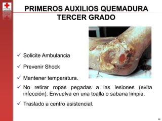 66
PRIMEROS AUXILIOS QUEMADURA
TERCER GRADO
 Solicite Ambulancia
 Prevenir Shock
 Mantener temperatura.
 No retirar ropas pegadas a las lesiones (evita
infección). Envuelva en una toalla o sabana limpia.
 Traslado a centro asistencial.
 