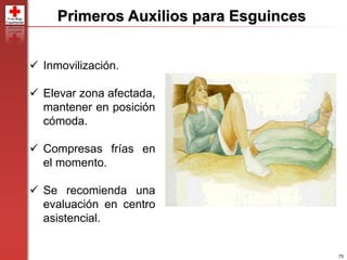 75
Primeros Auxilios para Esguinces
 Inmovilización.
 Elevar zona afectada,
mantener en posición
cómoda.
 Compresas frías en
el momento.
 Se recomienda una
evaluación en centro
asistencial.
 