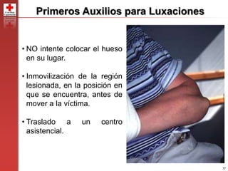 77
Primeros Auxilios para Luxaciones
• NO intente colocar el hueso
en su lugar.
• Inmovilización de la región
lesionada, en la posición en
que se encuentra, antes de
mover a la víctima.
• Traslado a un centro
asistencial.
 