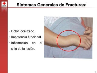 82
Síntomas Generales de Fracturas:
• Dolor localizado.
• Impotencia funcional.
• Inflamación en el
sitio de la lesión.
 