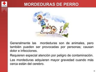 86
MORDEDURAS DE PERRO
Generalmente las mordeduras son de animales, pero
también pueden ser provocadas por personas; causan
dolor e infecciones.
Requieren especial atención por peligro de contaminación.
Las mordeduras adquieren mayor gravedad cuando más
cerca están del cerebro.
 