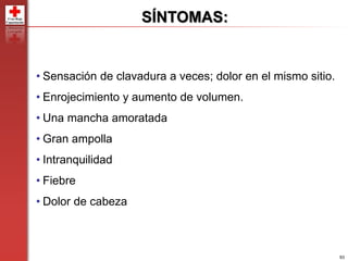 93
SÍNTOMAS:
• Sensación de clavadura a veces; dolor en el mismo sitio.
• Enrojecimiento y aumento de volumen.
• Una mancha amoratada
• Gran ampolla
• Intranquilidad
• Fiebre
• Dolor de cabeza
 