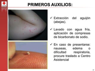 97
PRIMEROS AUXILIOS:
 Extracción del aguijón
(abejas).
 Lavado con agua fría,
aplicación de compresas
de bicarbonato de sodio.
 En caso de presentarse:
nauseas, edema o
dificultad respiratoria,
procure traslado a Centro
Asistencial
 