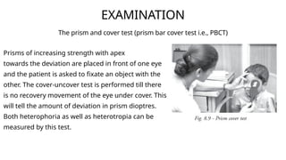 Squint ,types,heterophoria.pptx.......... | PPTX