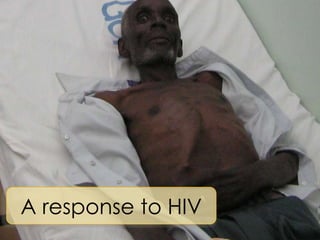 A response to HIV 