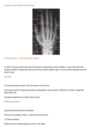 Normal Pa Hand Radiograph PA View of Hand (Radiography)_20250817_120156_0000.pdf