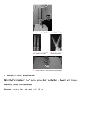 True Ap Hand PA View of Hand (Radiography)_20250817_120156_0000.pdf