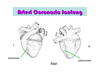 Arteri Coronaria JantungArteri Coronaria Jantung
Sapi
L
R
paraconal
subsinuosal
 